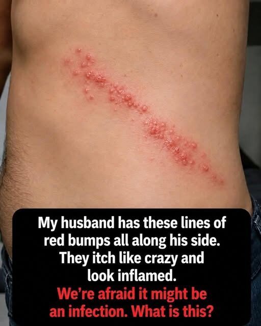 I Thought It Was a Harmless Habit… Until It Triggered a Rare Medical Nightmare!